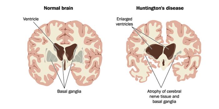 NEURODEGENERATIVE DISEASES